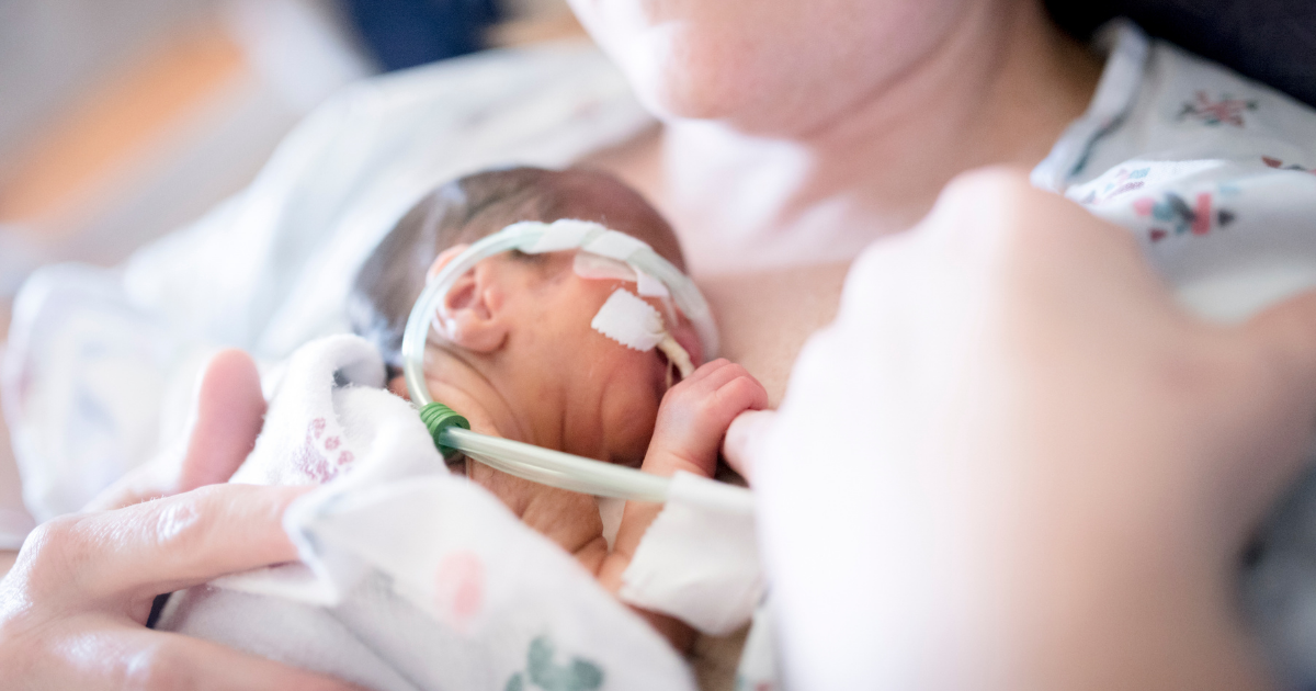 Infant receives nourishment in NICU (neonatal intensive care unit)